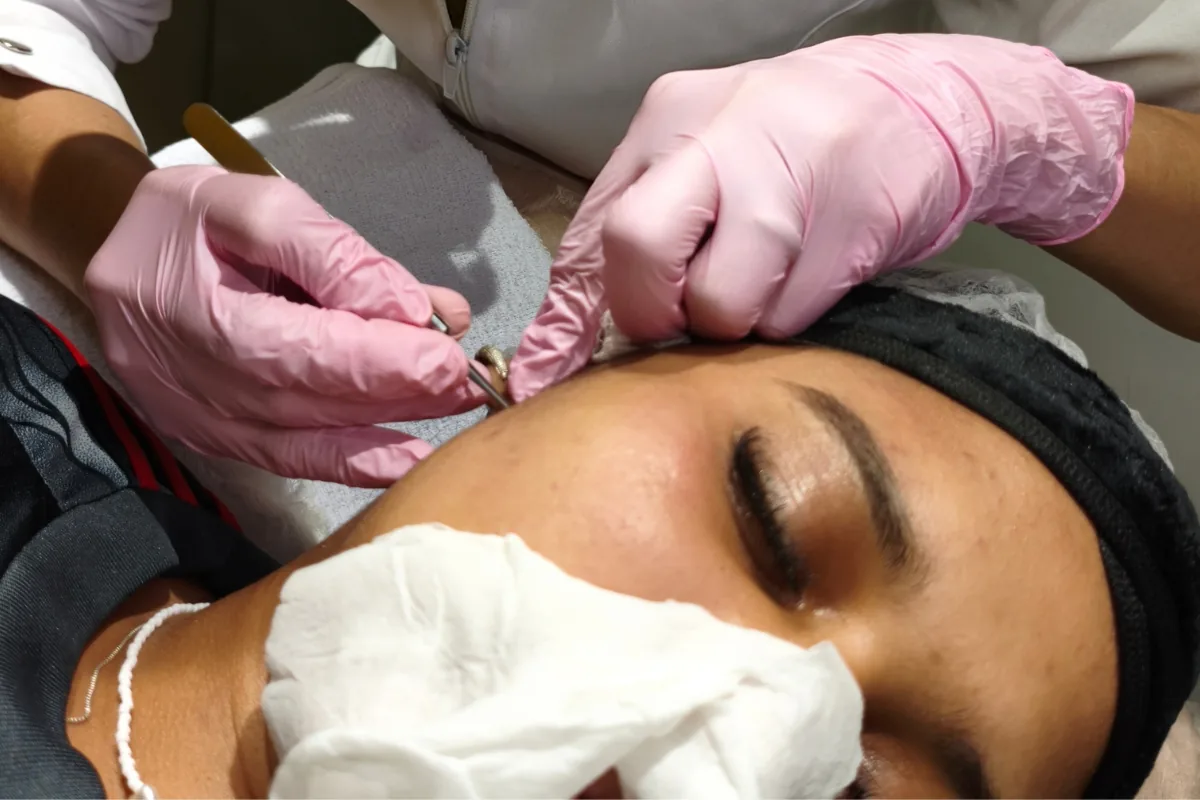Esteticista de luvas realizando procedimento facial com instrumental esterilizado